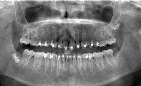 Radiología Oral