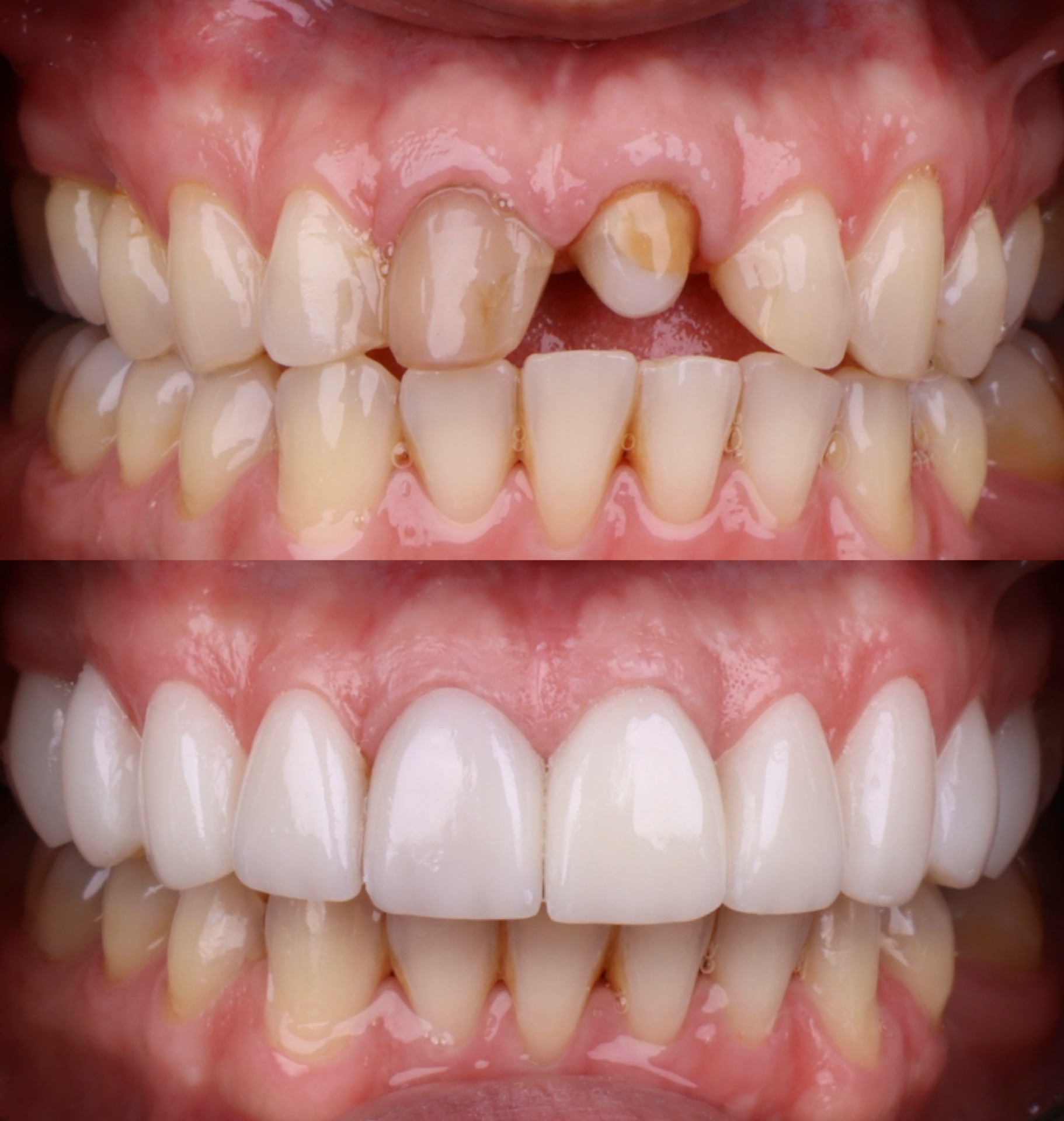 Rehabilitación Oral
